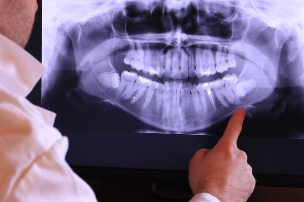 Trusted DE Emergency Dentist Experts